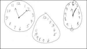 test del reloj