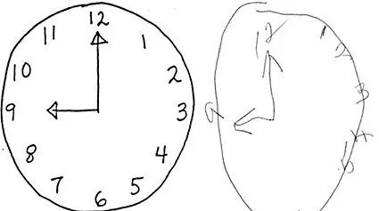 Test del reloj