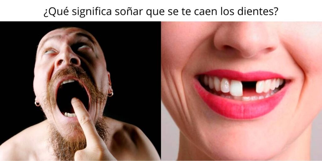 ¿Qué significa soñar que se te caen los dientes?